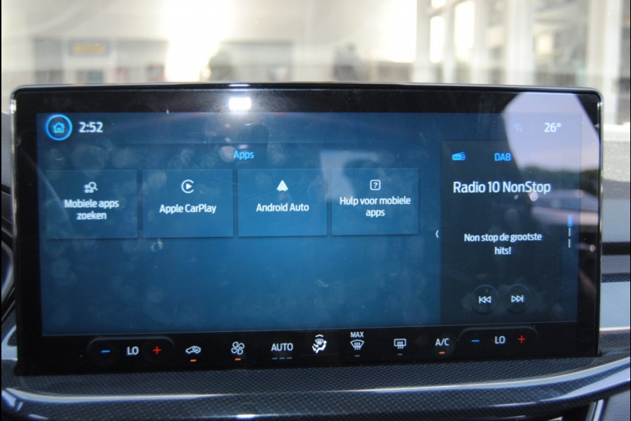 Ford Focus 1.0 EBH ST Line X | Carplay | Camera | Groot scherm | Navi