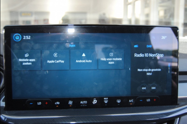 Ford Focus 1.0 EBH ST Line X | Carplay | Camera | Groot scherm | Navi